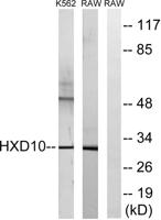 HoxD10 Polyclonal Antibody