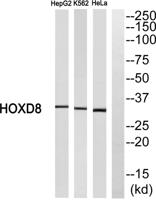 HoxD8 Polyclonal Antibody