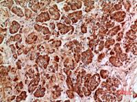 HPA1 Polyclonal Antibody