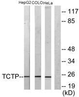 HRF Polyclonal Antibody