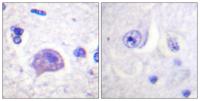 Hrs Polyclonal Antibody