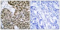 HSF1 Polyclonal Antibody