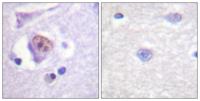 Sox-9 Polyclonal Antibody