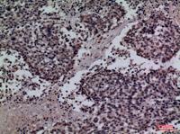 SP-A Polyclonal Antibody