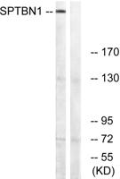 Spectrin β II Polyclonal Antibody