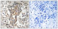 SphK2 Polyclonal Antibody