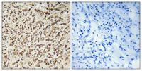 Spindlin-1 Polyclonal Antibody