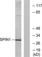 Spindlin-1 Polyclonal Antibody