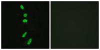 Splicing factor 1 Polyclonal Antibody