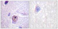 Splicing factor 1 Polyclonal Antibody