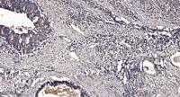 SPOP Polyclonal Antibody