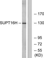 SPT16 Polyclonal Antibody