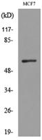 ALK-1 Polyclonal Antibody