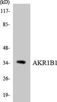 Aldose Reductase Polyclonal Antibody