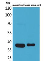 Aldolase C Polyclonal Antibody