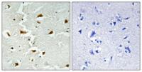 Aldolase B Polyclonal Antibody