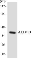 Aldolase B Polyclonal Antibody