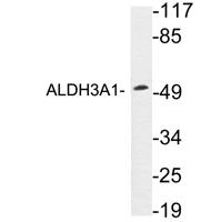 ALDH3A1 Polyclonal Antibody