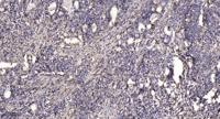 ALMS1 Polyclonal Antibody