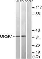 Olfactory receptor 5K1 Polyclonal Antibody