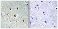 Abl1 (phospho Tyr204) Polyclonal Antibody