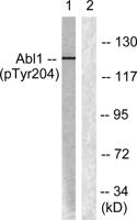 Abl1 (phospho Tyr204) Polyclonal Antibody