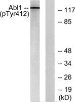 Abl1/2 (phospho Tyr393/439) Polyclonal Antibody