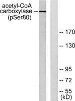 ACCα (phospho Ser80) Polyclonal Antibody