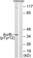 ARK-2 (phospho Tyr12) Polyclonal Antibody