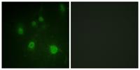 HMG-14 (phospho Ser21) Polyclonal Antibody