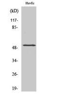 HNF4-α (phospho Ser313) Polyclonal Antibody