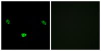 HNF4-α (phospho Ser313) Polyclonal Antibody