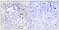 HNF4-α (phospho Ser313) Polyclonal Antibody