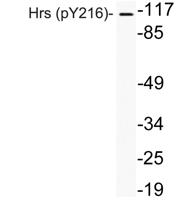 Hrs (phospho Tyr216) Polyclonal Antibody