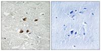 HSF1 (phospho Ser121) Polyclonal Antibody