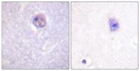 Sox-9 (phospho Ser181) Polyclonal Antibody