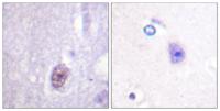 Sp1 (phospho Thr453) Polyclonal Antibody