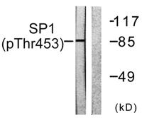 Sp1 (phospho Thr453) Polyclonal Antibody