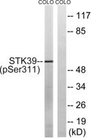 SPAK (phospho Ser309) Polyclonal Antibody