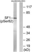 Splicing factor 1 (phospho Ser82) Polyclonal Antibody