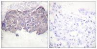 HSL (phospho Ser552) Polyclonal Antibody