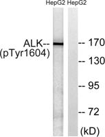 ALK (phospho Tyr1604) Polyclonal Antibody