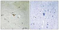 ALK (phospho Tyr1096) Polyclonal Antibody