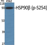 HSP90β (phospho Ser254) Polyclonal Antibody