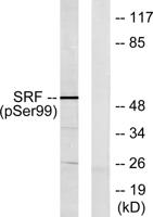 SRF (phospho Ser103) Polyclonal Antibody