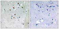 SRF (phospho Ser77) Polyclonal Antibody