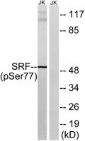 SRF (phospho Ser77) Polyclonal Antibody