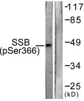 SSB (phospho Ser366) Polyclonal Antibody