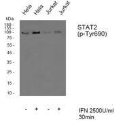 Stat2 (phospho Tyr690) Polyclonal Antibody