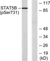 Stat5 (phospho Ser726/731) Polyclonal Antibody